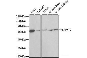 Western blot analysis of extracts of various cell lines using SHMT2 Polyclonal Antibody at dilution of 1:1000. (SHMT2 anticorps)