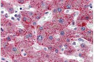 Human Liver: Formalin-Fixed, Paraffin-Embedded (FFPE) (SERPING1 anticorps  (AA 1-501))