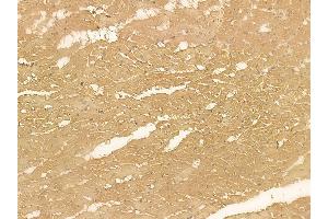 CED6 Mouse Monoclonal Antibody at 1/100 staining rat heart tissue by IHC-P. (GULP1 anticorps)