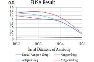 Black line: Control Antigen (100 ng),Purple line: Antigen (10 ng), Blue line: Antigen (50 ng), Red line:Antigen (100 ng)