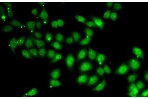 Immunofluorescence analysis of U2OS cells using AFF1 Polyclonal Antibody (AF4 anticorps)