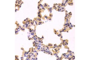 Immunohistochemistry of paraffin-embedded Rat lung using CASP3 antibody at dilution of 1:100 (x400 lens). (Caspase 3 anticorps  (AA 100-200))