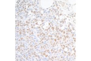 anti-Suppressor of Ty 6 Homolog (SUPT6H) (AA 425-475) antibody