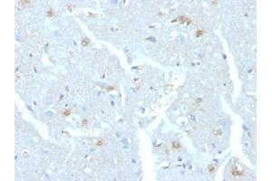 Formalin-fixed, paraffin-embedded human brain stained with UBE2C Mouse Monoclonal Antibody (CPTC-UBE2C-1)