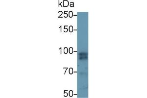 Detection of STAT4 in Mouse Spleen lysate using Polyclonal Antibody to Signal Transducer And Activator Of Transcription 4 (STAT4)