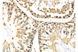 ABIN6263302 and ABIN6266595 at 1/100 staining Rat testis tissue by IHC-P.