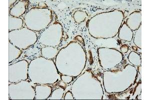 Immunohistochemical staining of paraffin-embedded Human thyroid tissue using anti-XPNPEP1 mouse monoclonal antibody. (XPNPEP1 anticorps)