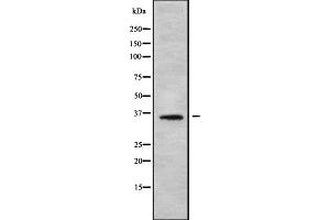 Western blot analysis OR56B2 using HT-29 whole cell lysates (OR56B2 anticorps)
