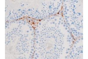 ABIN6267523 at 1/200 staining Mouse testis tissue sections by IHC-P.