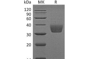 Western Blotting (WB) image for SLAM Family Member 8 (SLAMF8) protein (His tag) (ABIN7320649) (SLAMF8 Protein (His tag))