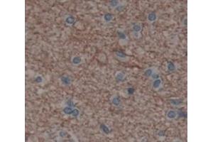 IHC-P analysis of Kidney tissue, with DAB staining. (IL20RA anticorps  (AA 269-545))