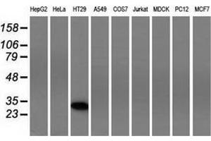 Western blot analysis of extracts (35 µg) from 9 different cell lines by using anti-FHL1 monoclonal antibody. (FHL1 anticorps)