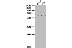 Western Blot Positive WB detected in: Daudi whole cell lysate, U87 whole cell lysate All lanes: ACVRL1 antibody at 1:2000 Secondary Goat polyclonal to rabbit IgG at 1/50000 dilution Predicted band size: 57 kDa Observed band size: 65 kDa