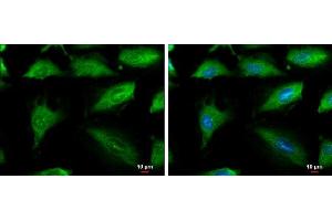 ICC/IF Image Aconitase 1 antibody [N1C1] detects Aconitase 1 protein at cytoplasm by immunofluorescent analysis.