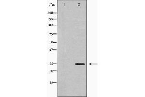 Western blot analysis of Mouse brain lysate, using PRDX6 Antibody. (Peroxiredoxin 6 anticorps  (Internal Region))
