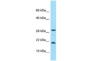 WB Suggested Anti-CRYGN Antibody Titration: 1. (CRYGN anticorps  (C-Term))