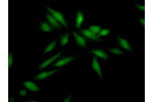Immunofluorescence staining of Hela Cells with ABIN7127812 at 1:50, counter-stained with DAPI. (Recombinant SKP2 anticorps)