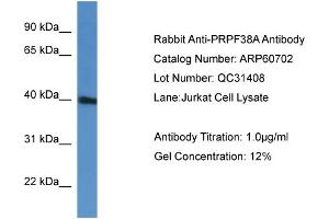 WB Suggested Anti-PRPF38A  Antibody Titration: 0.