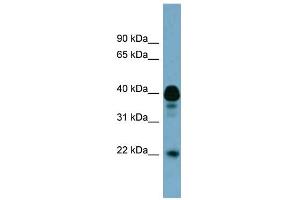 WB Suggested Anti-FAM45B Antibody Titration: 0. (FAM45B anticorps  (Middle Region))