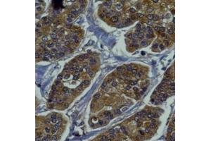 anti-RAB27B, Member RAS Oncogene Family (RAB27B) (C-Term) antibody