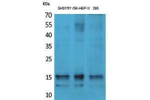 Western Blotting (WB) image for anti-Synuclein, alpha (SNCA) (pTyr125) antibody (ABIN3182994) (SNCA anticorps  (pTyr125))