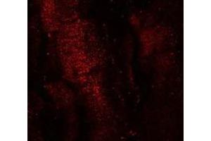 anti-Mex-3 Homolog B (MEX3B) (Middle Region) antibody