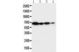 Anti-NOX2/gp91phox antibody, Western blotting Lane 1: HELA Cell Lysate Lane 2: JURKAT Cell Lysate Lane 3: MCF-7 Cell Lysate Lane 4: SMMC Cell Lysate (CYBB anticorps  (Middle Region))