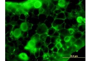 Immunofluorescence of purified MaxPab antibody to FLT1 on 293 cell.