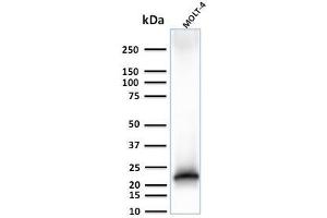 Western Blot Analysis of MOLT-4 cell lysate using CD3e Rabbit Recombinant Monoclonal Antibody (C3e/3125R).