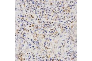Immunohistochemistry (IHC) image for anti-Secretin Receptor (SCTR) antibody (ABIN3017416) (SCTR anticorps)