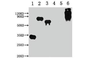 Western Blot Positive WB detected in: 1-3 lanes: E-tagged fusion protein, 4-5 lanes: Recombinant protein without E-tagged, 6 lane: BSA-E-Tag All lanes: E-Tag antibody at 1:1000 Secondary Goat polyclonal to Mouse IgG at 1/10000 dilution Predicted band size: 30, 68, 55, 67-157 kDa Observed band size: 30, 68, 55, 67-157 kDa (E Tag anticorps)