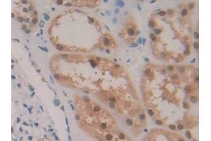 Detection of GR in Human Kidney Tissue using Polyclonal Antibody to Glutathione Reductase (GR)