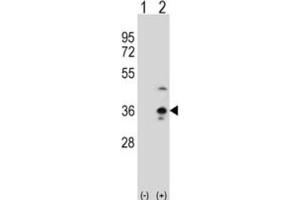Western Blotting (WB) image for anti-Collectin Sub-Family Member 11 (COLEC11) antibody (ABIN3002827)