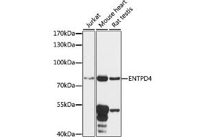 Western blot analysis of extracts of various cell lines, using ENTPD4 antibody (ABIN7266893) at 1:1000 dilution. (ENTPD4 anticorps  (AA 350-470))