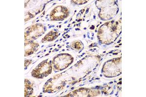 Immunohistochemistry of paraffin-embedded human colon using RPN1 antibody. (RPN1 anticorps)