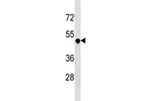 DR3 antibody western blot analysis in 293 lysate.