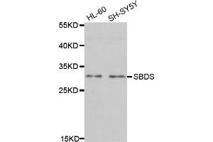 Western Blotting (WB) image for anti-Shwachman-Bodian-Diamond Syndrome (SBDS) antibody (ABIN1980243)