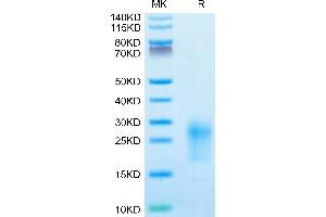 Mouse TIGIT on Tris-Bis PAGE under reduced condition.