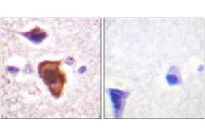 Immunohistochemistry analysis of paraffin-embedded human brain tissue, using CD88/C5aR (Ab-338) Antibody.
