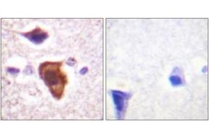 Immunohistochemistry analysis of paraffin-embedded human brain tissue, using CD88/C5aR (Ab-338) Antibody. (C5AR1 anticorps  (AA 301-350))