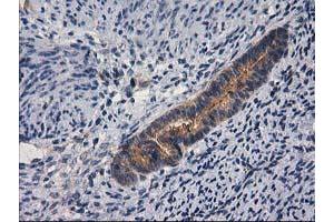 Image no. 16 for anti-Glucosidase, Beta, Acid 3 (Cytosolic) (GBA3) (AA 1-150), (AA 370-469) antibody (ABIN1490582)