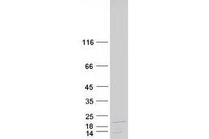 Validation with Western Blot
