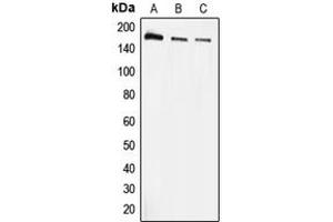 Western blot analysis of EEA1 expression in A431 (A), HeLa (B), THP1 (C) whole cell lysates. (EEA1 anticorps  (N-Term))