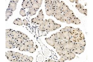 ABIN7094801 and ABIN7098852 at 1/100 staining Rat pancreatic tissue by IHC-P. (L3MBTL1 anticorps  (Internal Region))