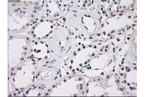 Immunohistochemical staining of paraffin-embedded endometrium tissue using anti-FHmouse monoclonal antibody. (FH anticorps)