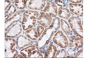 Immunohistochemical staining of paraffin-embedded Human liver tissue using anti-RAB17 mouse monoclonal antibody. (RAB17 anticorps)