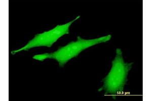 Immunofluorescence of monoclonal antibody to RRM2B on HeLa cell.