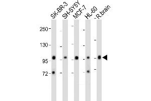 All lanes : Anti-PCDH20 Antibody (Center) at 1:2000 dilution Lane 1: SK-BR-3 whole cell lysate Lane 2: SH-SY5Y whole cell lysate Lane 3: MCF-7 whole cell lysate Lane 4: HL-60 whole cell lysate Lane 5: Rat brain whole cell lysate Lysates/proteins at 20 μg per lane. (PCDH20 anticorps  (AA 445-472))