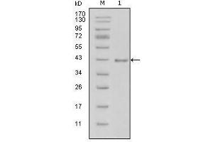 Western Blot showing LAMB1 antibody used against truncated LAMB1-His recombinant protein (1). (Laminin anticorps  (AA 31-270))
