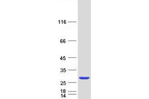 Validation with Western Blot